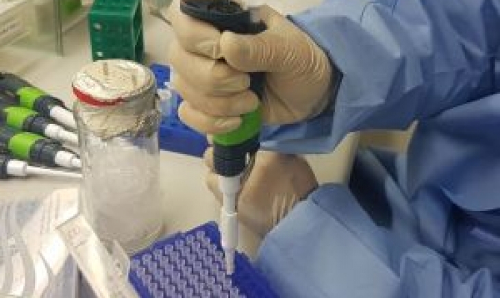 Exame para identificar vírus Zika é comercializado no país